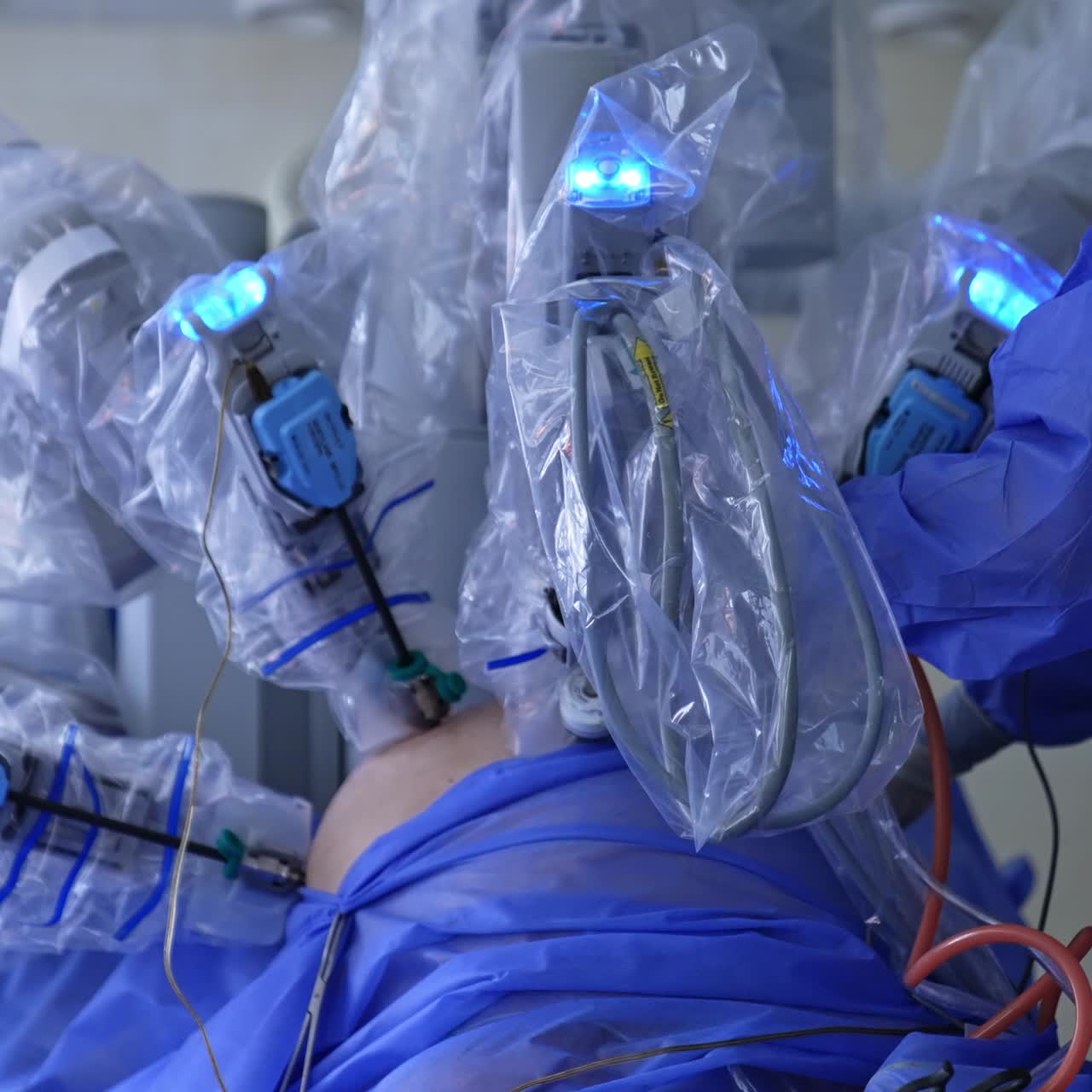 Futuristic medical equipment operating the patient. Da Vinci robot performing laparoscopy under the surgeon's control