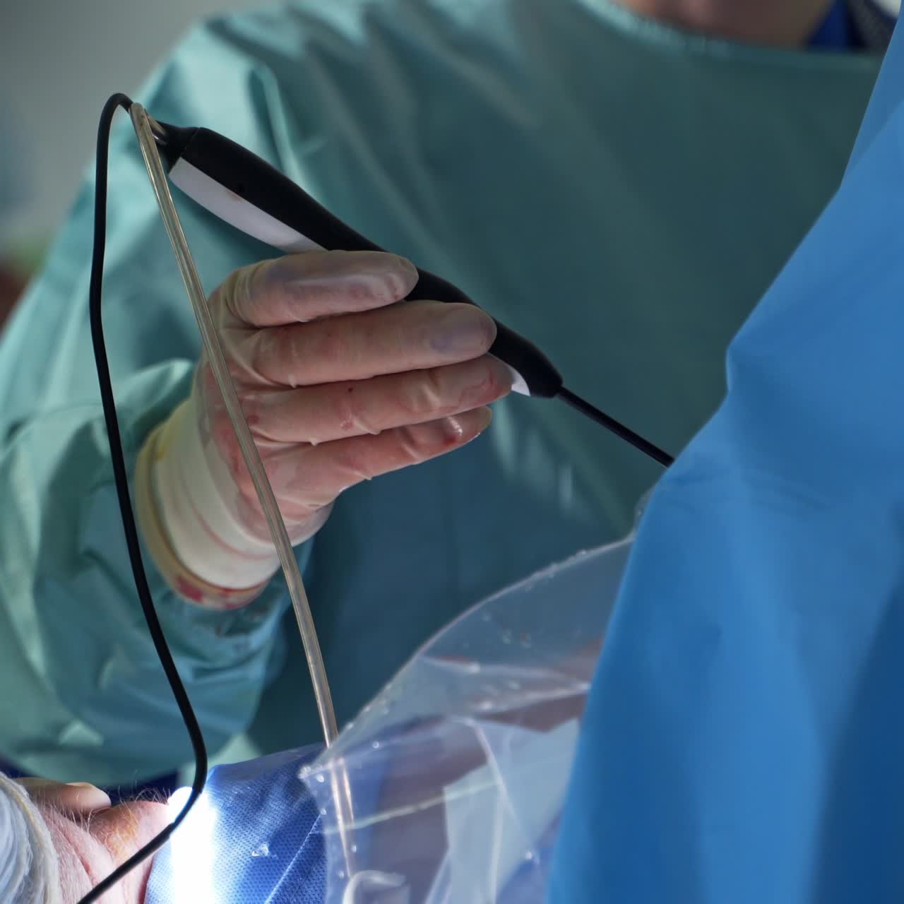 Gloved hand of a surgeon holds black device with tubes. Medical specialist moves electric instrument input into patient's body