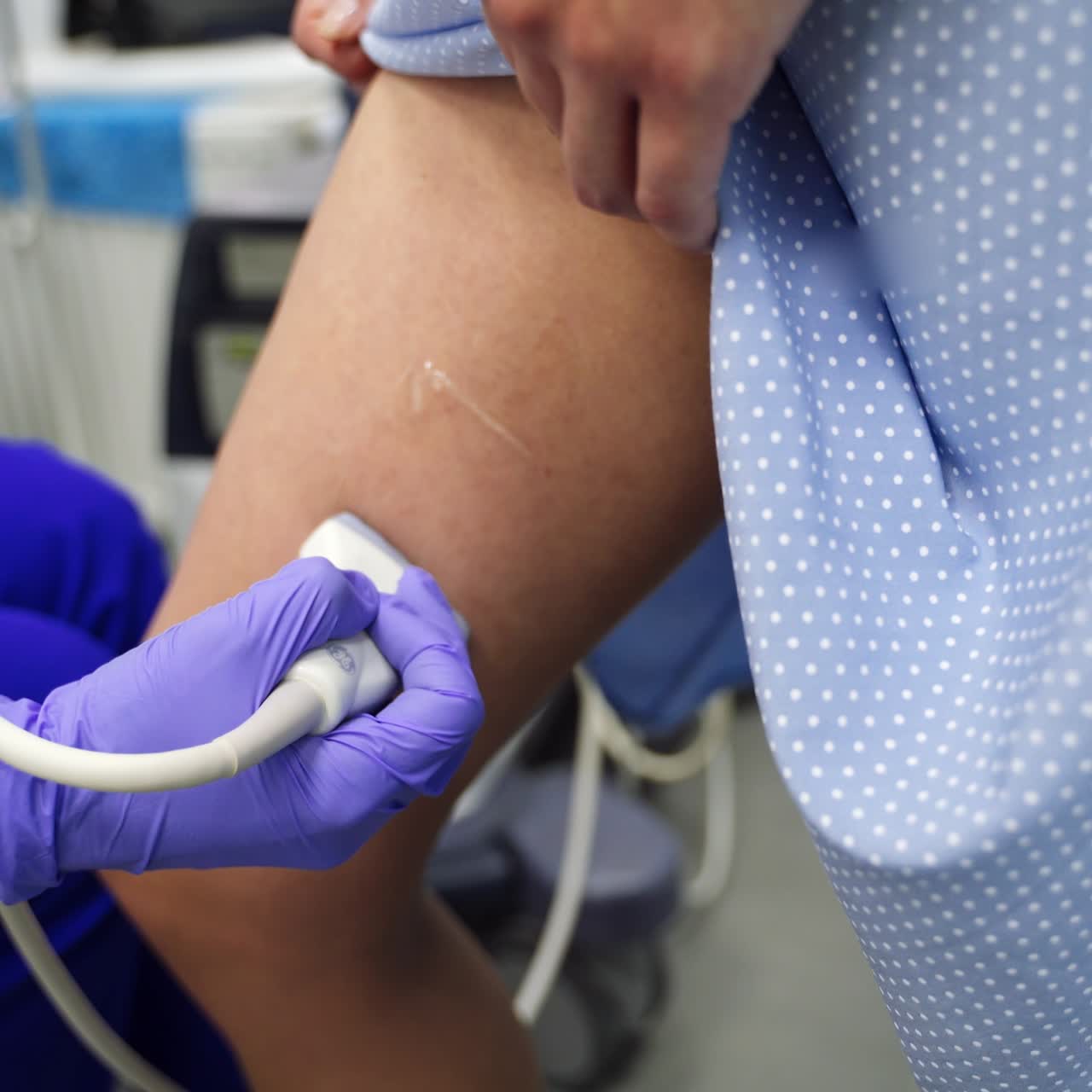 Gloved hand of medic moving transducer of ultrasound machine over the female thigh. Vascular check up in the clinics