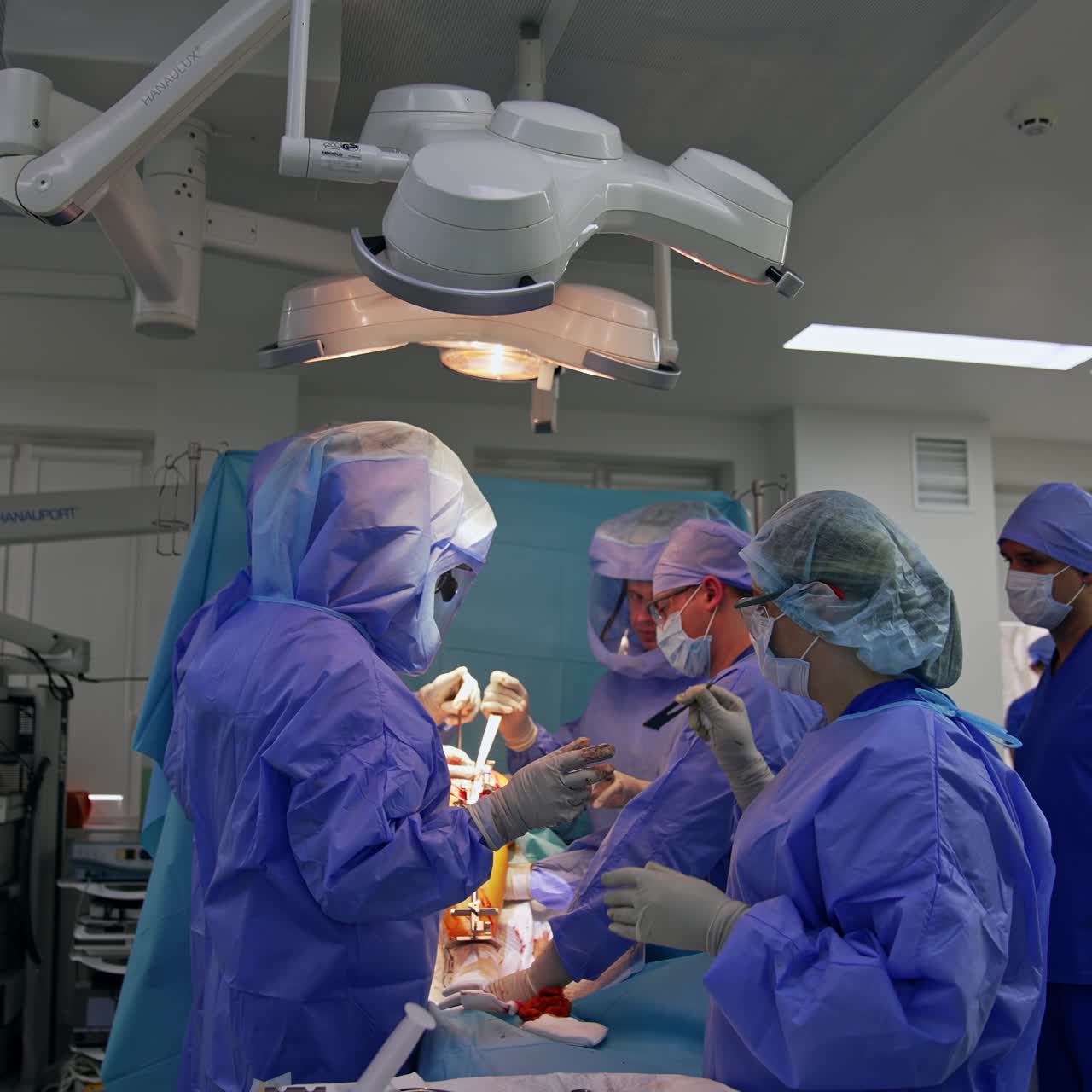 Large surgical team carrying out the surgery in modern operational theatre. Male anesthesiologist stands beside watching the procedure
