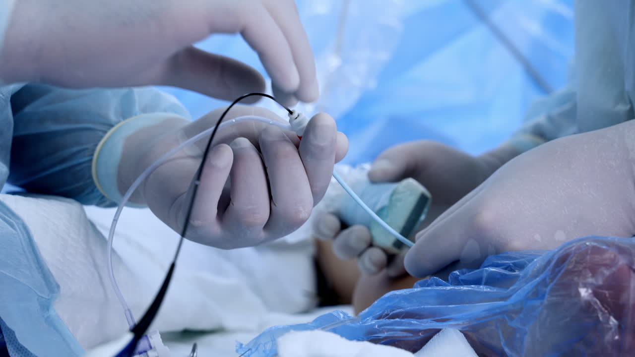 Male gloved hands holding and using the surgical tools and devices. Close up. Vascular operation in process.