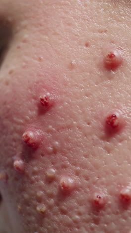 skin condition with red bumps on the face