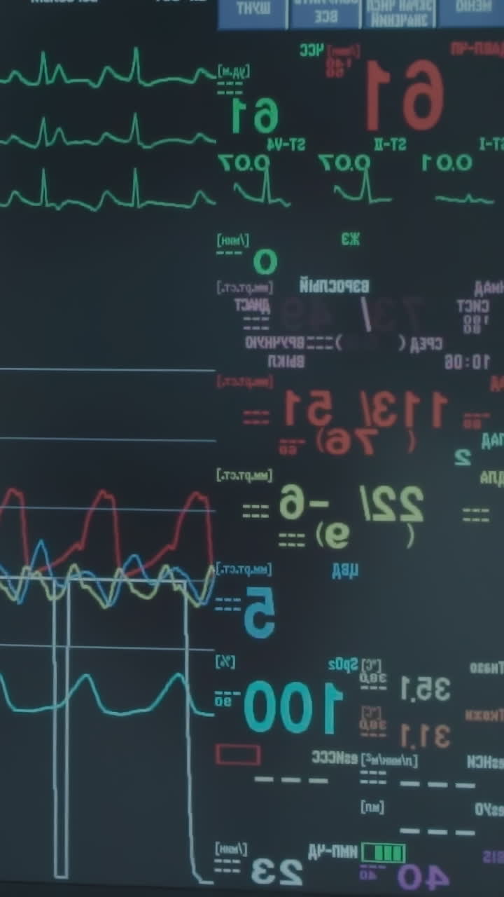 Monitoring system in surgical procedure. State-of-the-art monitoring system tracks patient vital signs throughout coronary artery bypass surgery