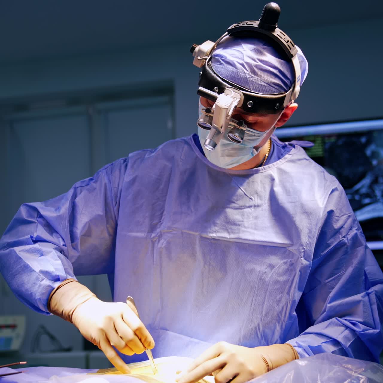 Un neurochirurgo usa un bisturi per effettuare un’incisione. Fase iniziale di un intervento neurologico. L’assistente prepara gli strumenti.
