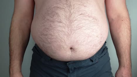 an overweight man cannot hold in his stomach anymore