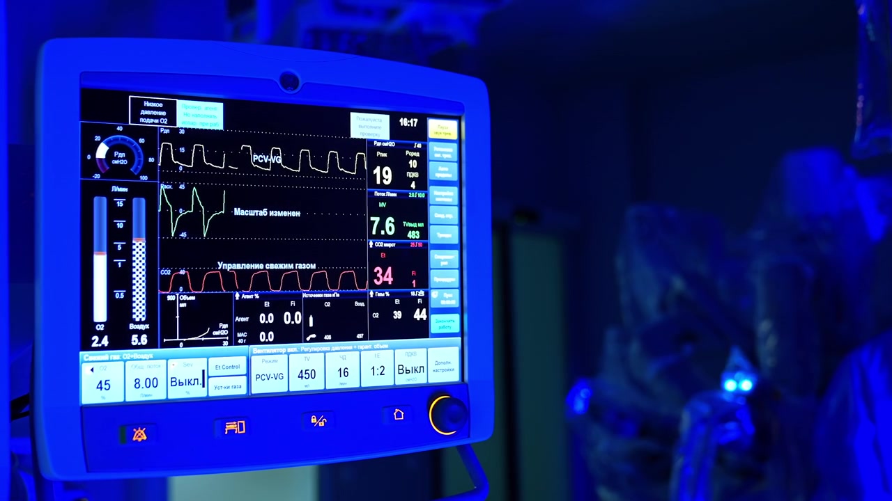 Kiev, Ucraina, 5 maggio 2026: Schermo della postazione di anestesia con parametri di ventilazione durante un intervento di chirurgia robotica in una sala illuminata di blu.