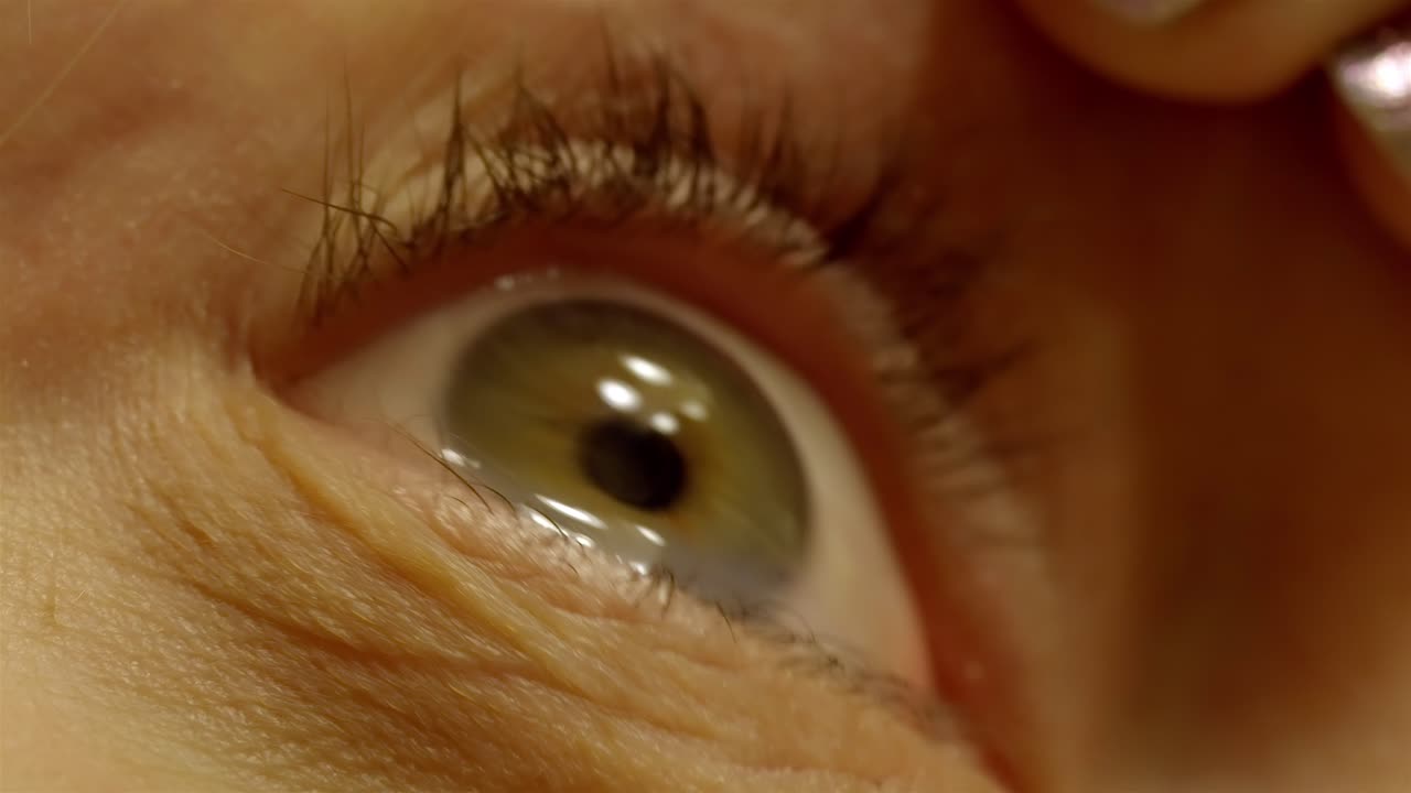 Extreme Close-up: Eye Drop Application to Contact Lens