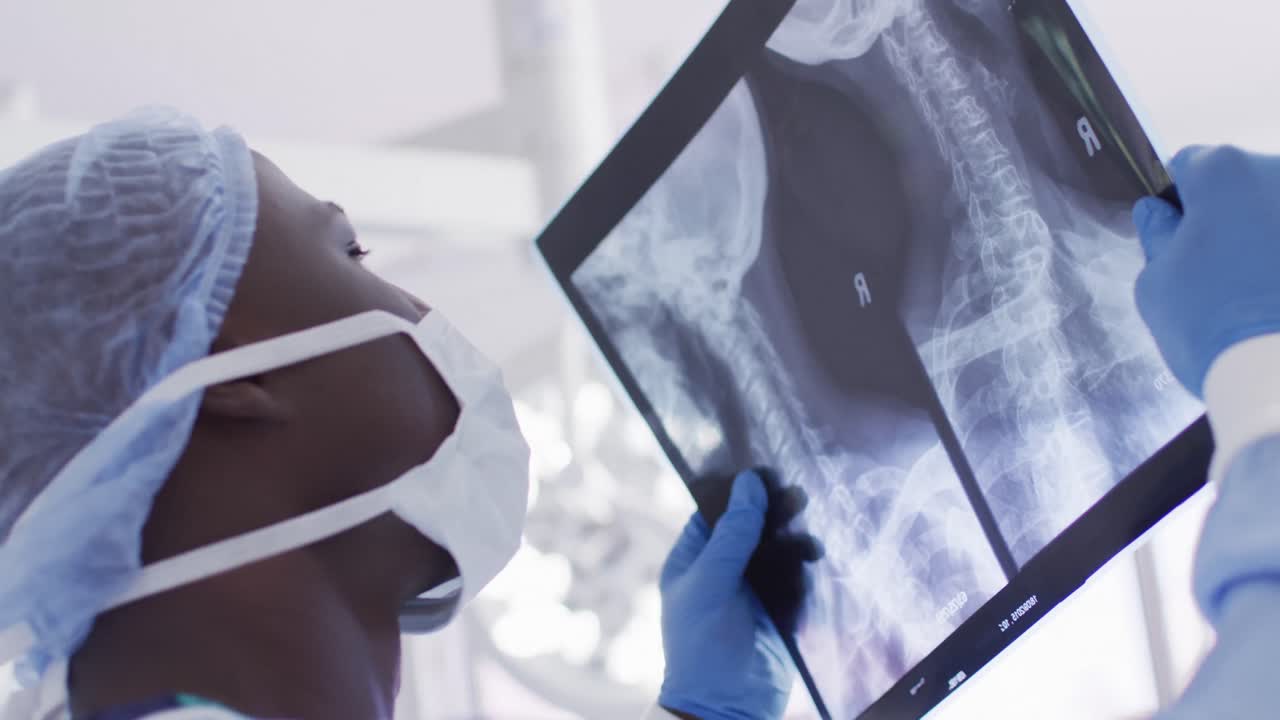 Video close up of african american male surgeon studying x-ray in operating theatre