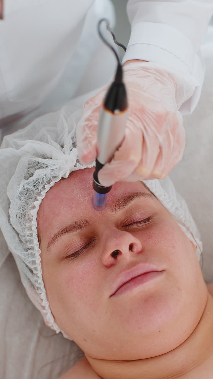 Cosmetologist doing peeling procedure, woman skin regeneration, dermapen microneedling, dermastamp