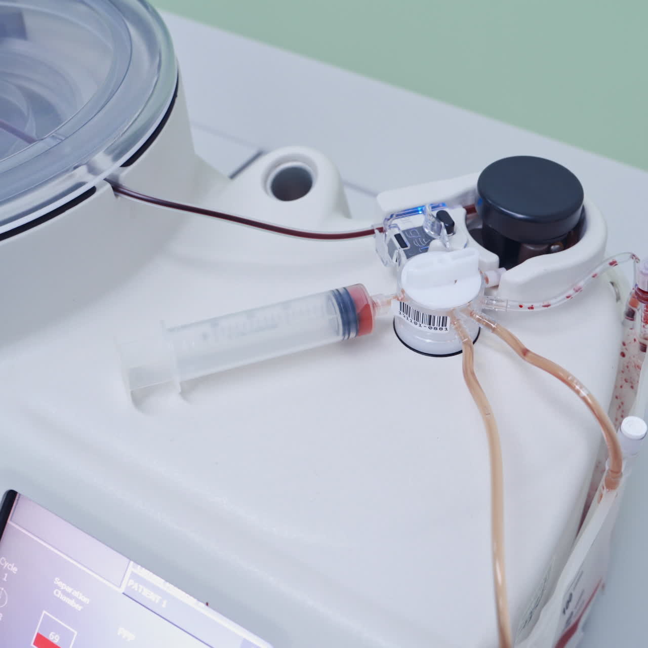 Terapia con cellule staminali. Plasma in siringa. Centrifuga.
