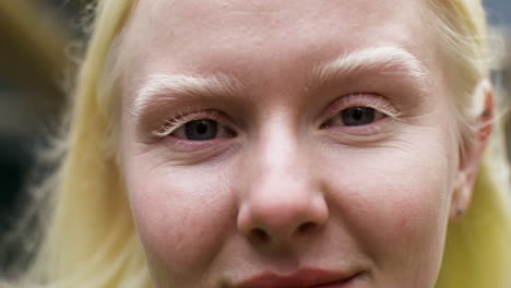 Closeup-albino-woman's-face