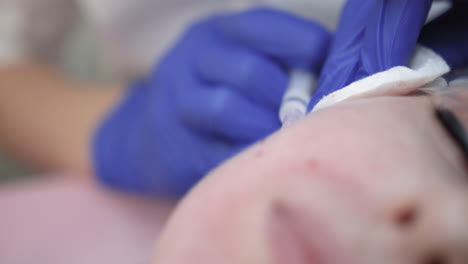 procedimiento de inyección facial