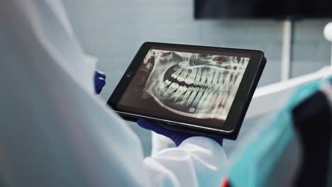dental x-ray on tablet