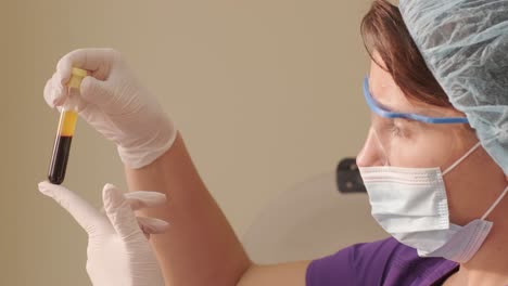 preparación de plasma rico en plaquetas. tubo con sangre en las manos.