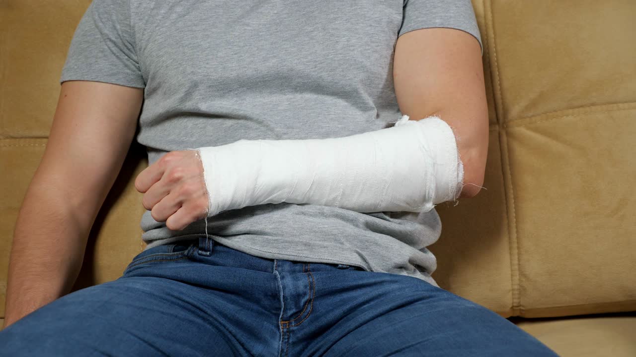 los dedos de la frente dañada se mueven en vendajes de yeso blanco