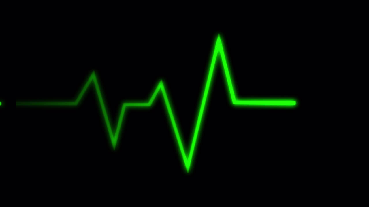 Monitor de ECG/EKG exibindo pulso e linha reta