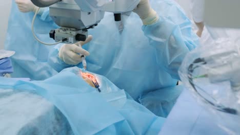 ophthalmological surgery specialist sits in front of microscope performing operation. low angle view on the female doctor conducting high-precision surgery. femto laser assisted cataract surgery.