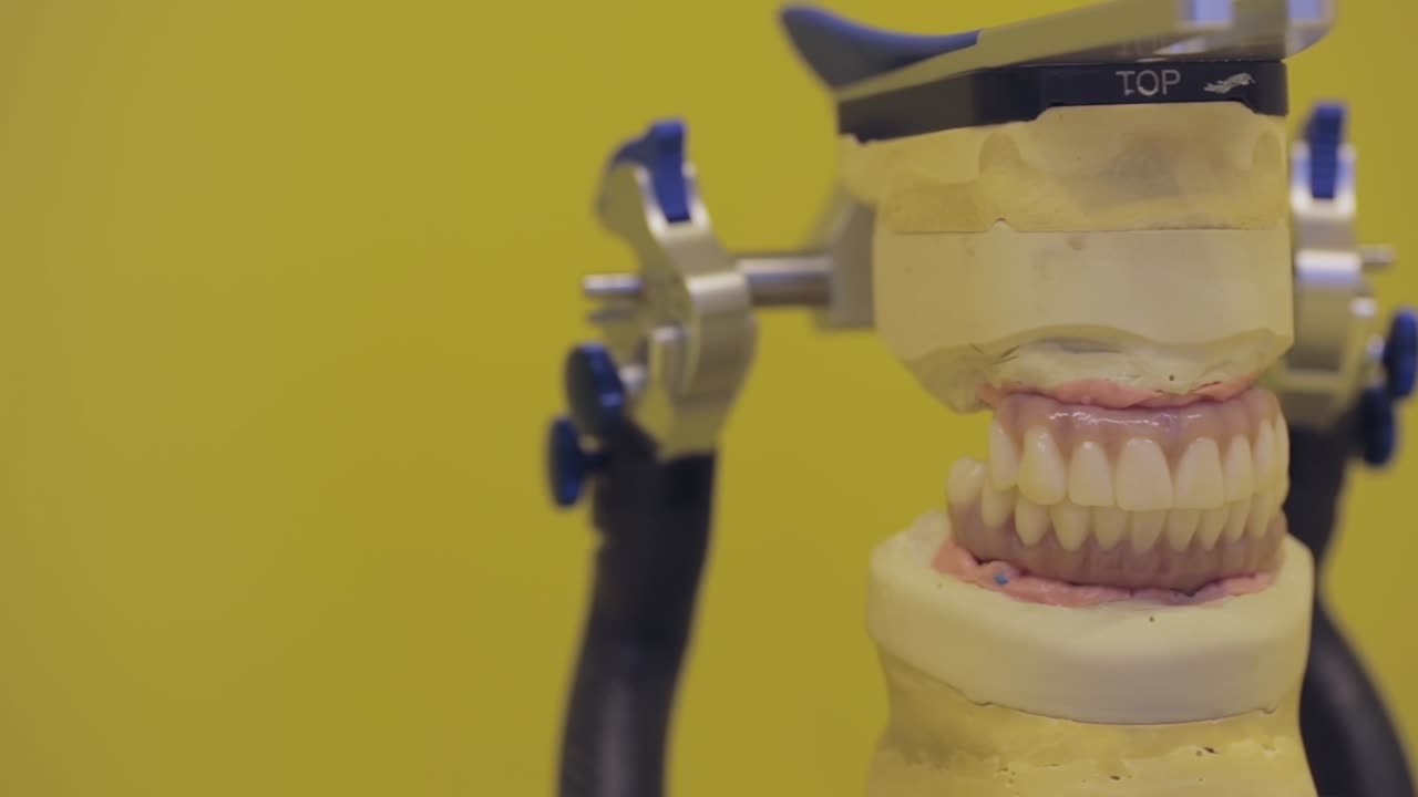 Dental model with articulator device, showcasing precise alignment of teeth