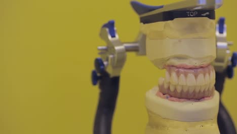 dental model with articulator device, showcasing precise alignment of teeth
