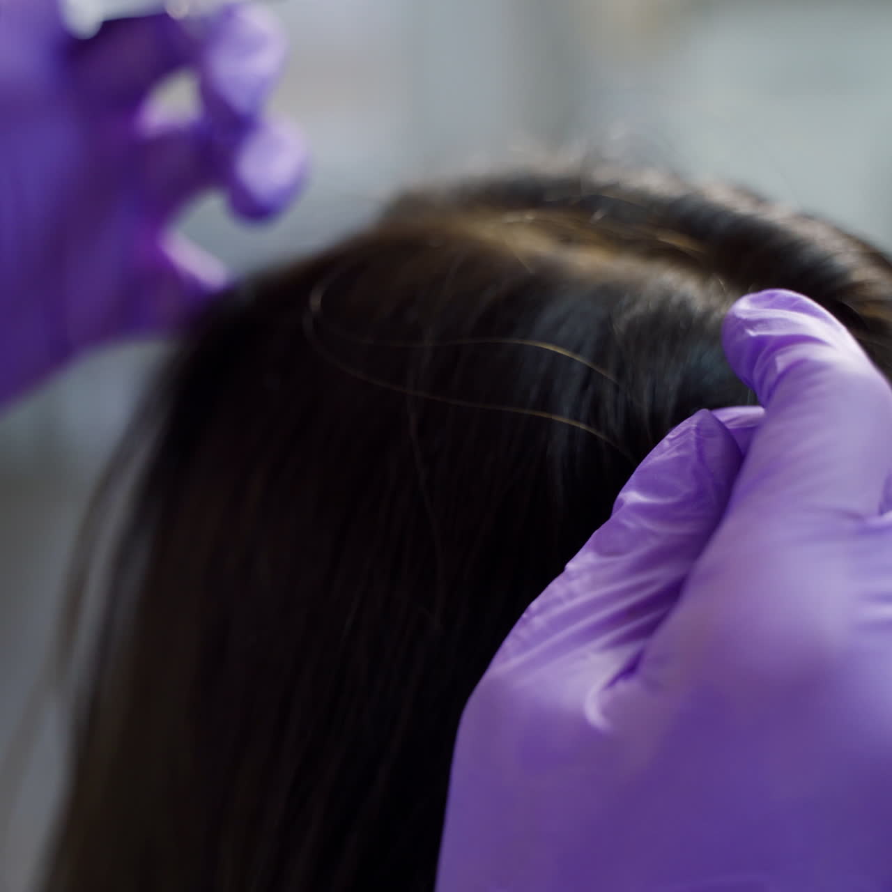 A beautiful young woman receives an injection in the head in the center of aesthetic medicine. Prevention and treatment of hair growth