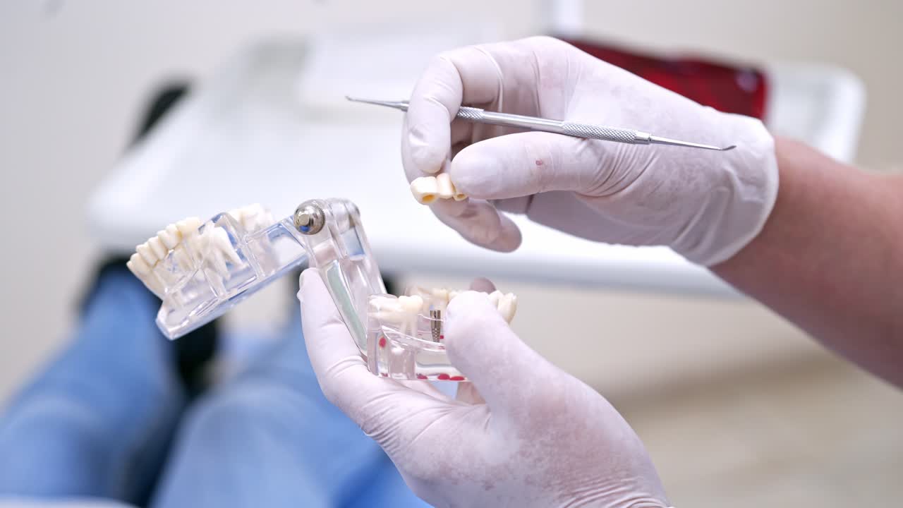 Doctor holding teeth model. Dentist holding educational model of oral cavity in clinic