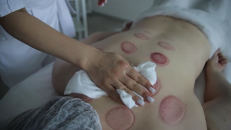 sesión de terapia de ventosas