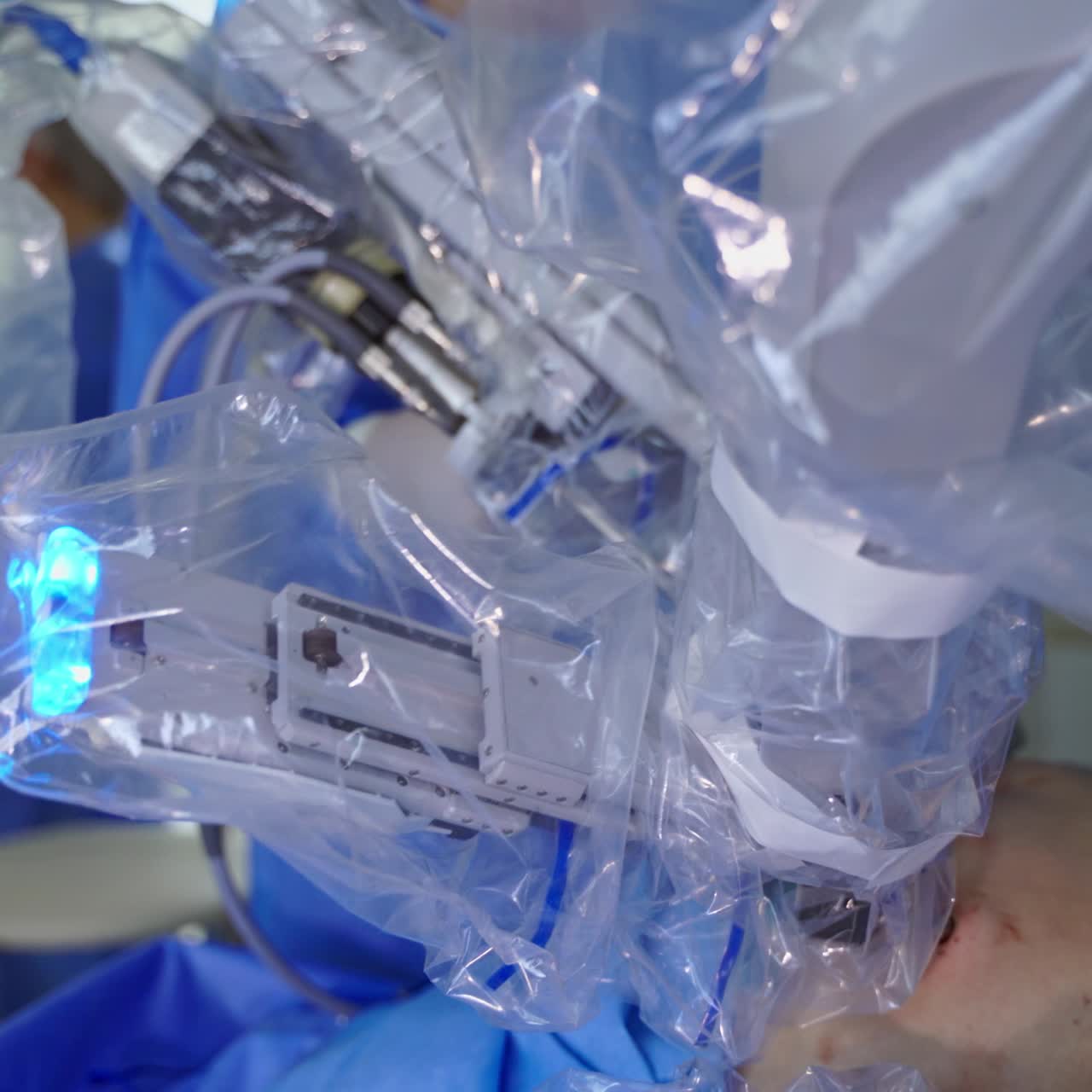 Medical robot perform a surgery. Robotic arms in patient's body during minimally invasive surgery. High-tech equipment in medicine. Close-up