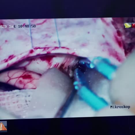 modern surgical system