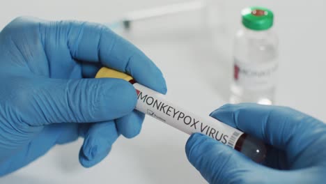 hands of doctor holding vial with monkeypox virus