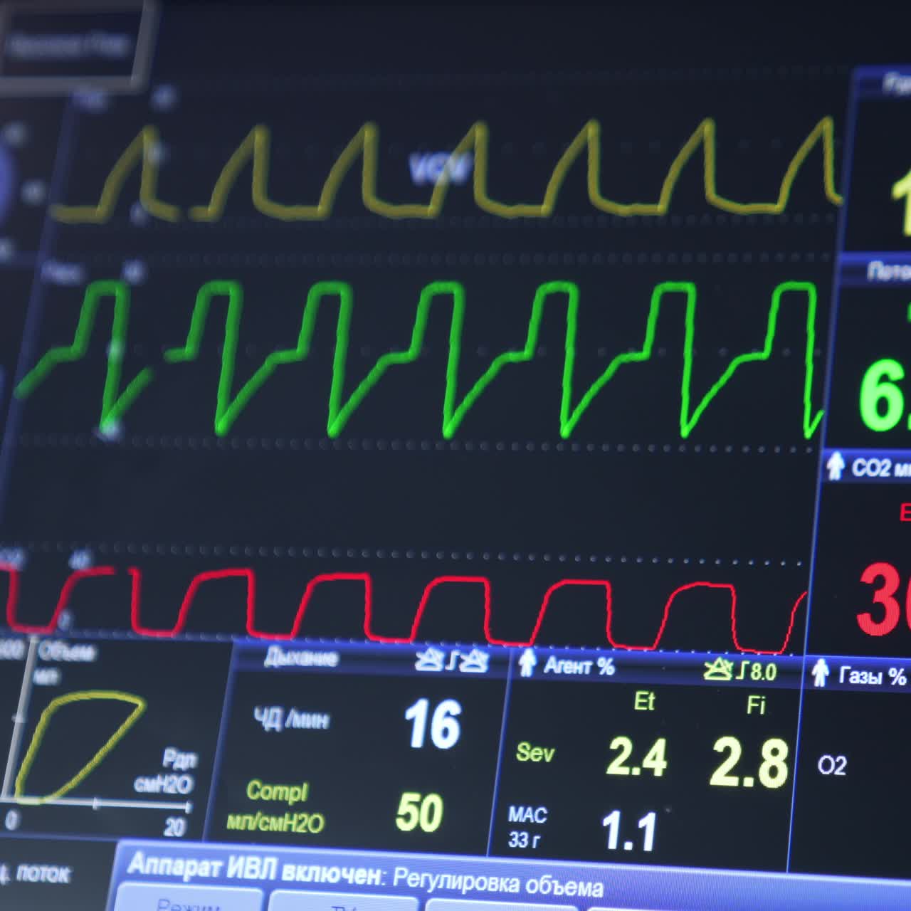 Monitor displaying life signs of operated patient. Curved lines and figures on the sensor screen of equipment in surgery room