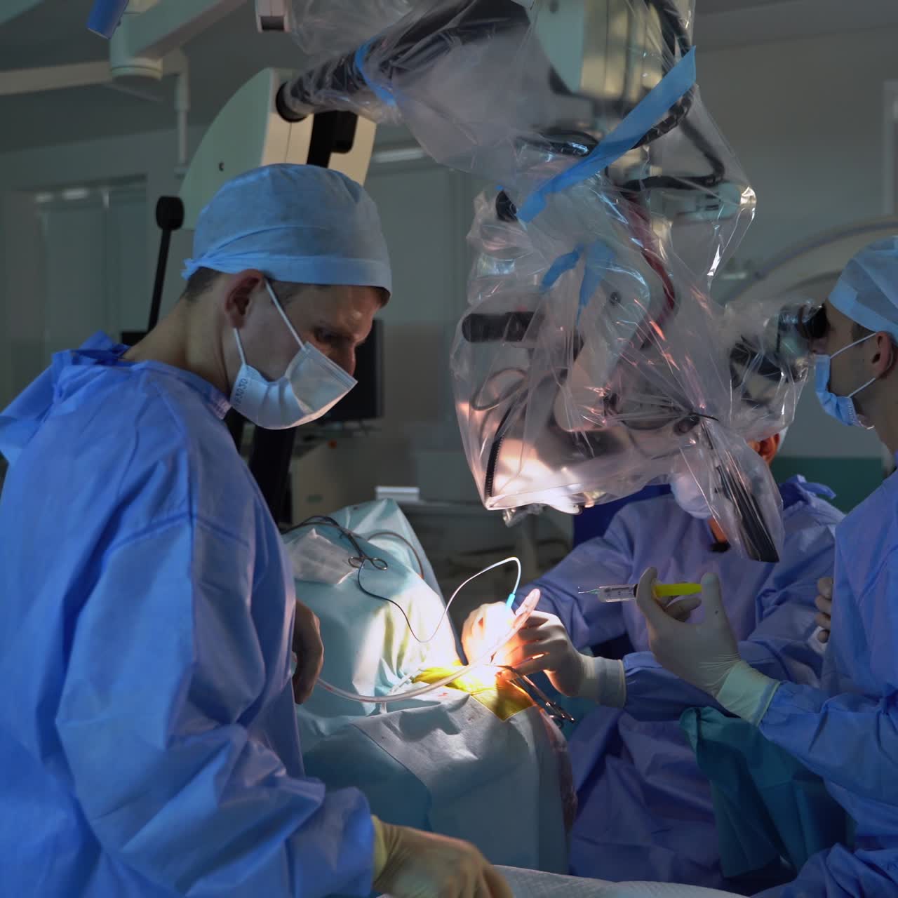 Neurosurgery operation in process. Doctor looks into microscope and holds a syringe in his hand. Another surgeon applies electric device