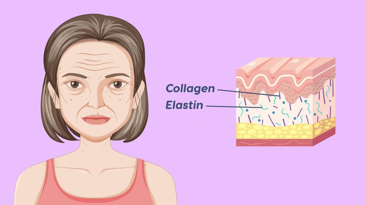 노화된 피부와 그 구성 요소의 일러스트레이션