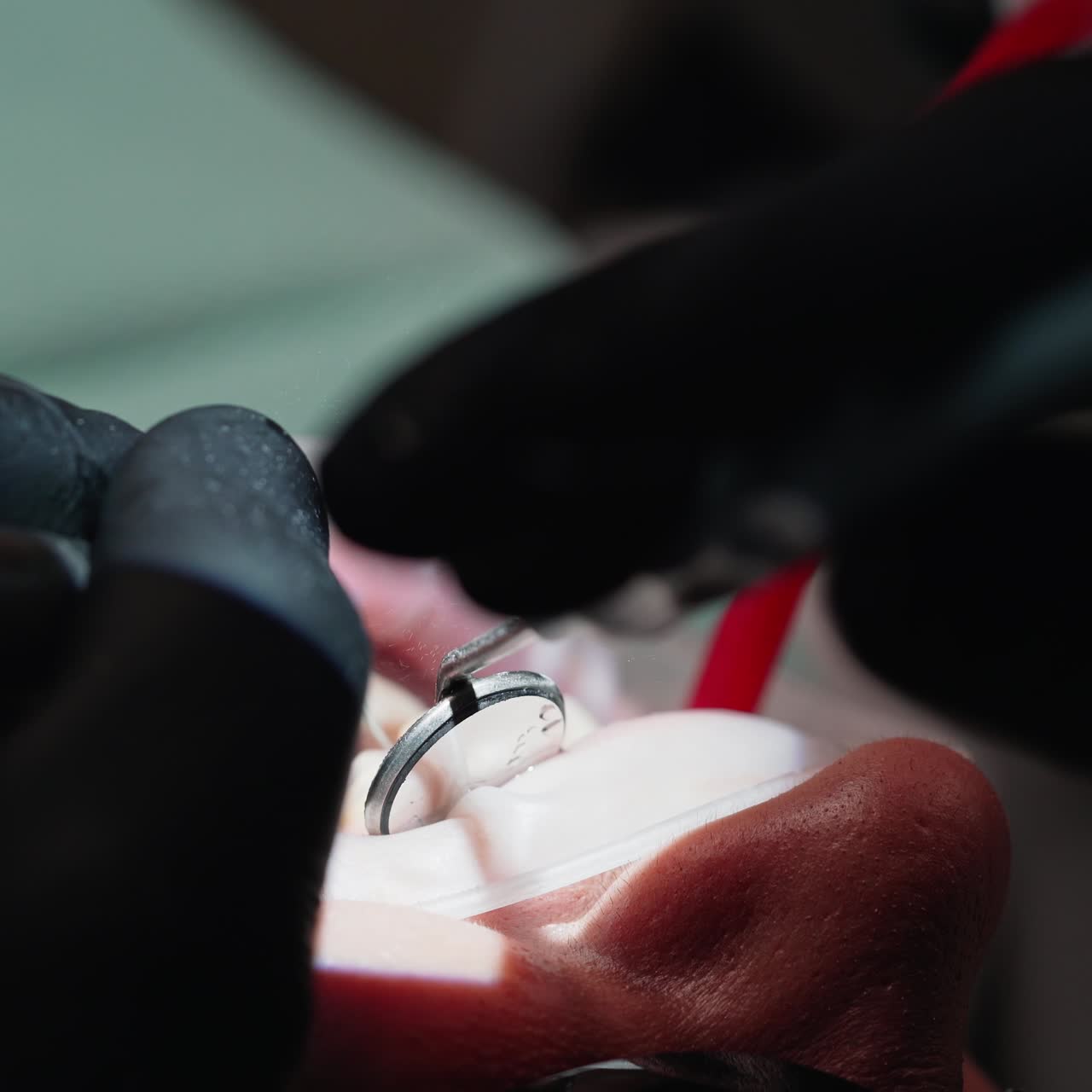 Dentista che esegue un intervento.