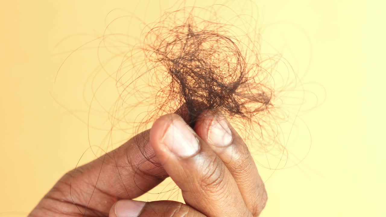 Hair Loss in Hand