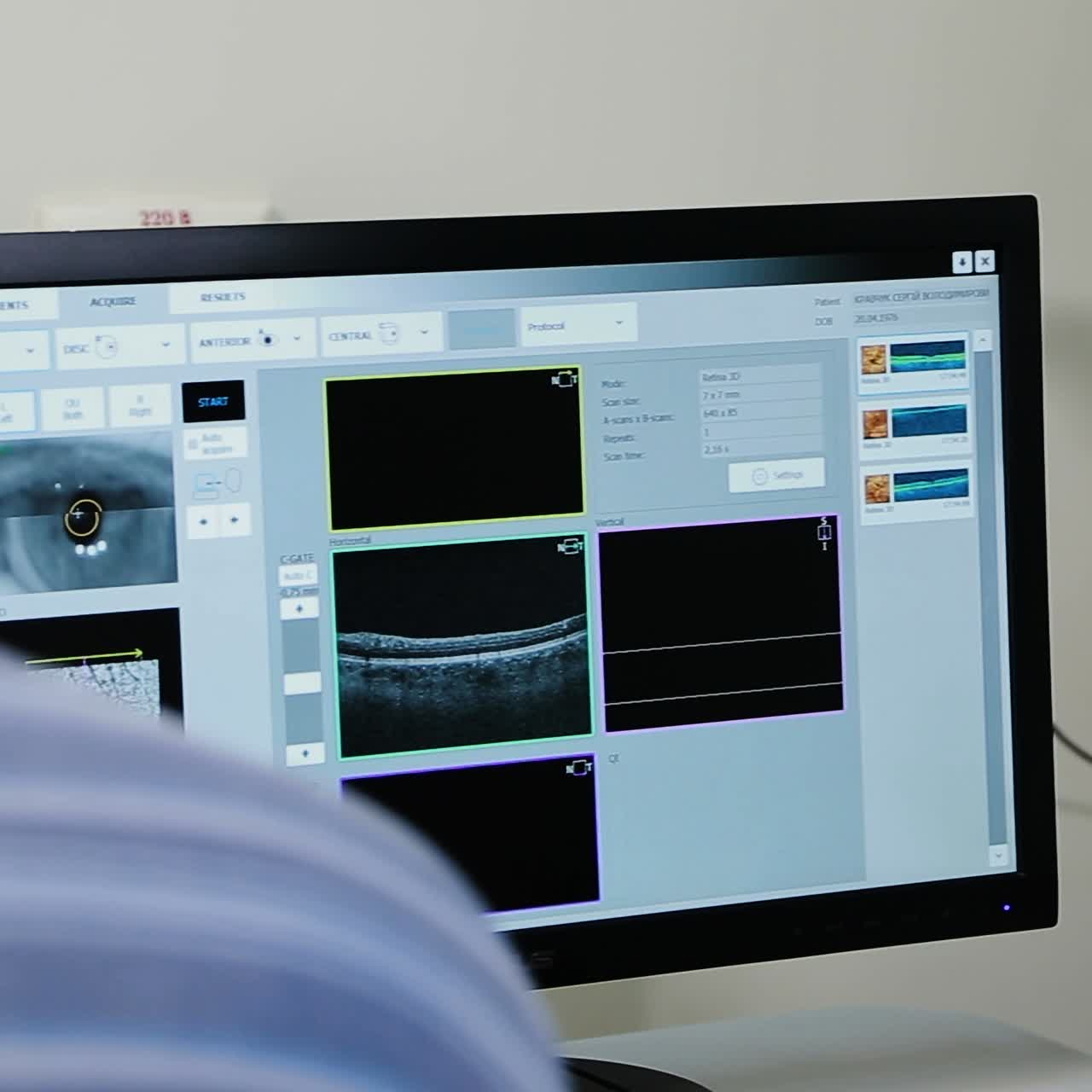 Eye Examination and Diagnostics Using OCT