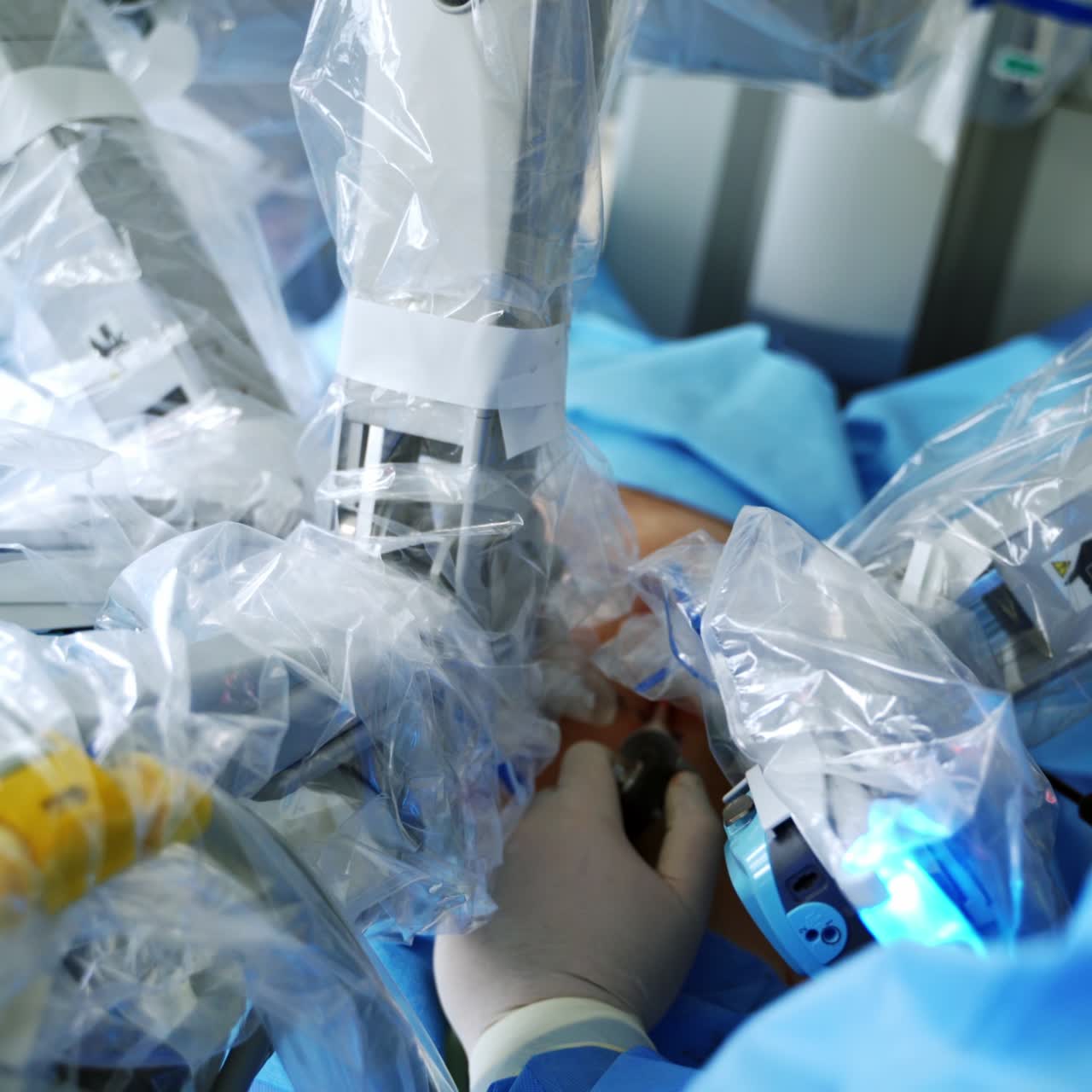 Robotic machine part of medical equipment. Surgeon's hand and robotic arms of a futuristic technology during operation on a patient. Close-up.