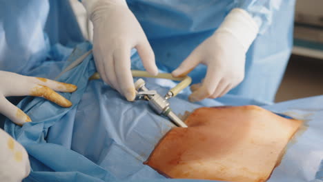 surgical procedure