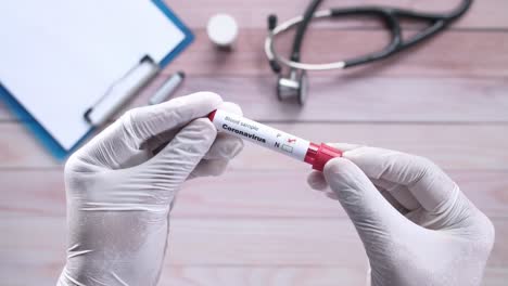 resultado negativo del análisis de sangre para el coronavirus