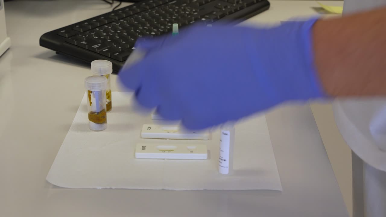 técnico de laboratorio intercambiando muestras de heces humanas con una pequeña varilla preparándola para el análisis de sangre en heces y goteando solución líquida marrón en un casete de prueba rápida en un pequeño laboratorio médico