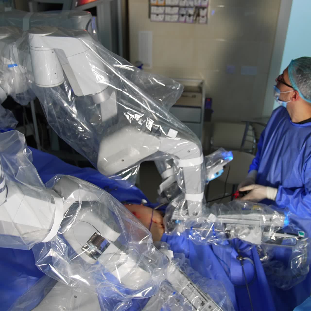 Abdominal surgery performed by innovative robotic equipment. Da Vinci system operating the patient. Doctor holds the instrument and looks at the screen
