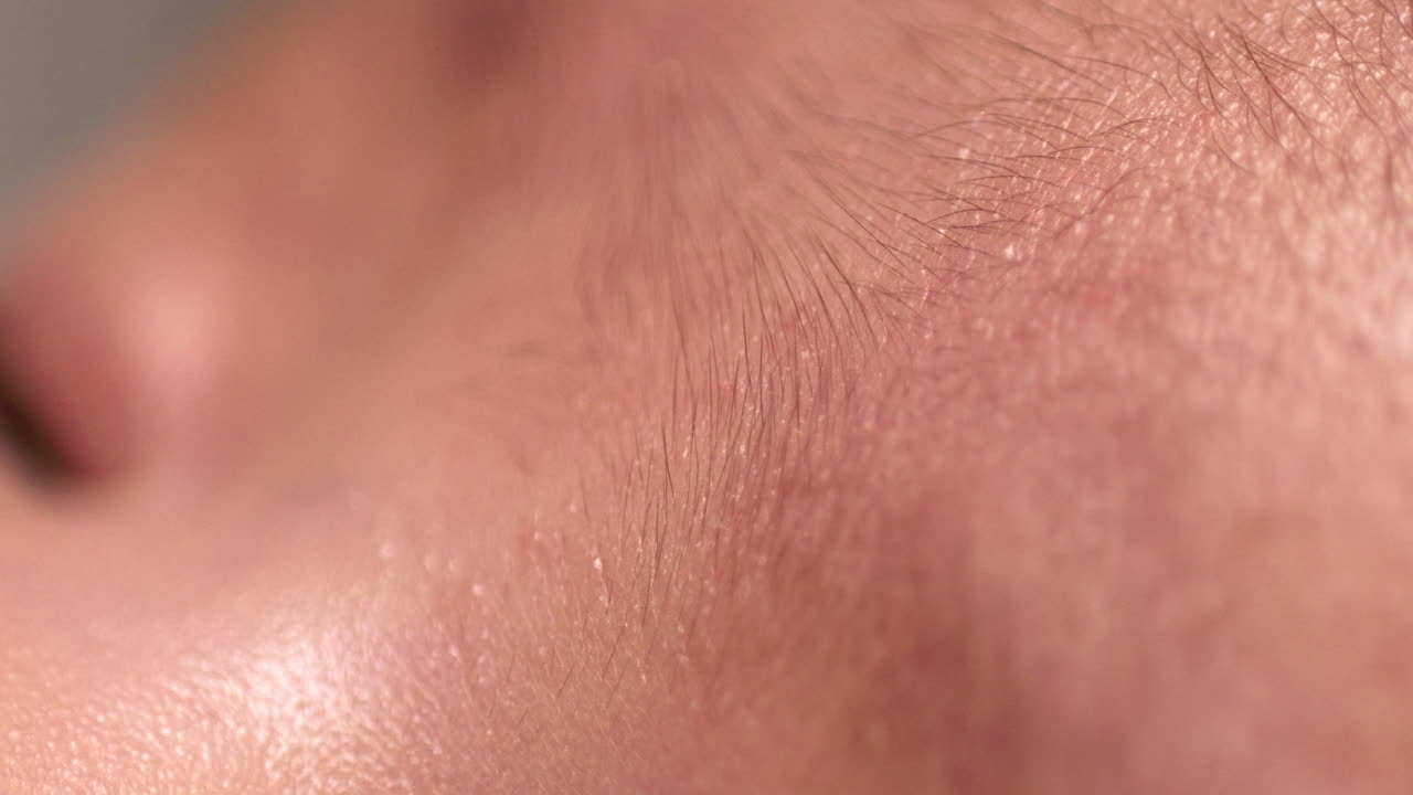 Close-up shot of a newborn baby's face, showing the reddish skin rashes of its face.