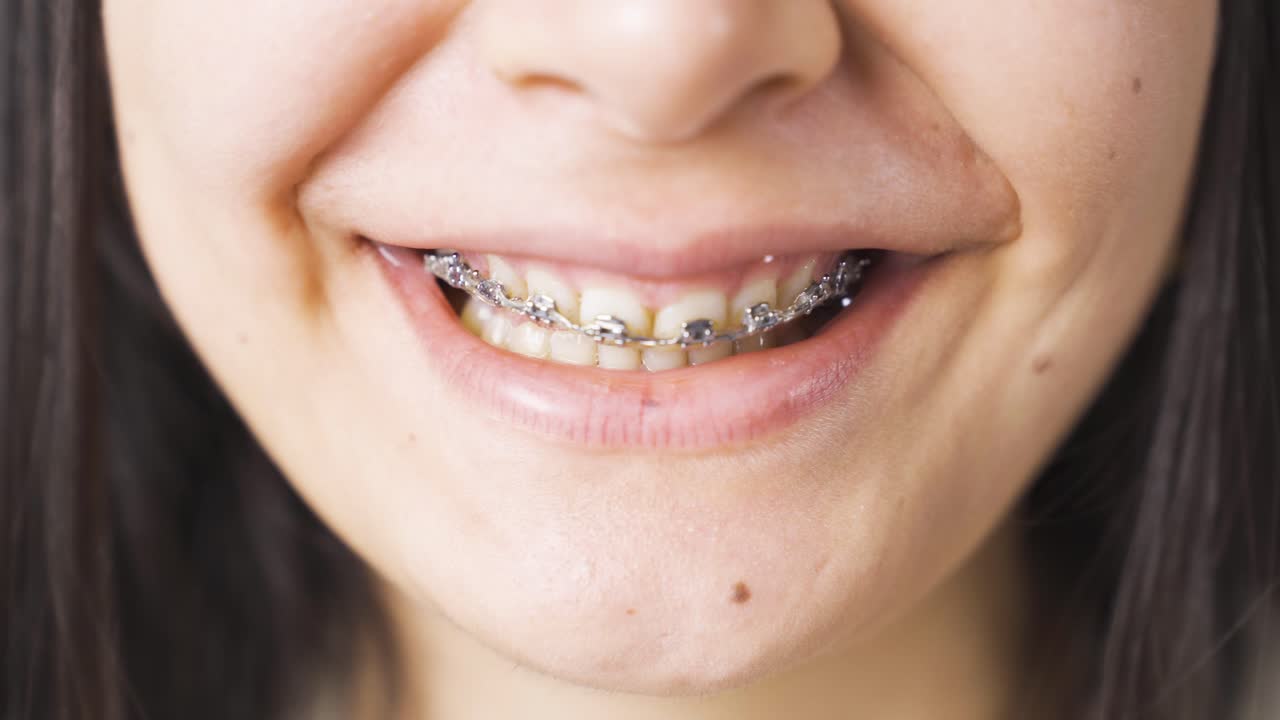 신경 ⁇ 약에 걸린 젊은 여성이 비명을 지르고 비명을 지르고 있었습니다.