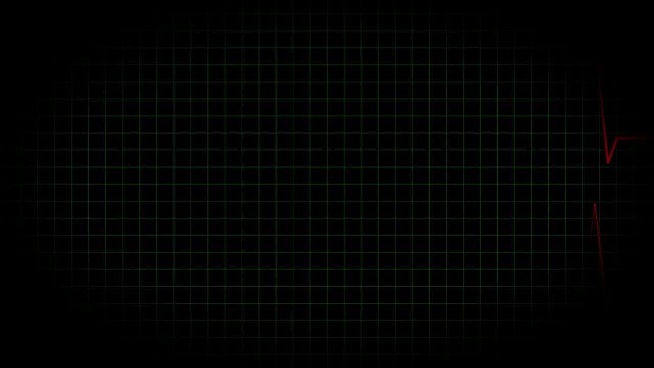 электрокардиограмма осциллоскоп волновая форма анимация движущаяся графика