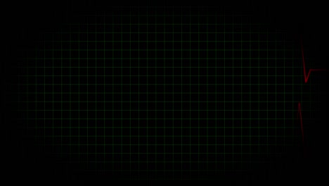 electrocardiograma osciloscopio forma de onda animación gráficos de movimiento