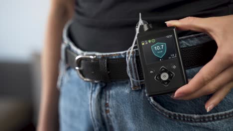 Diabetic-female-showing-insulin-pump-on-her-waist-belt,-close-up