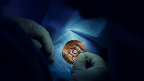 patient under surgical microscope. patient and surgeon in the operating room during ophthalmic surgery