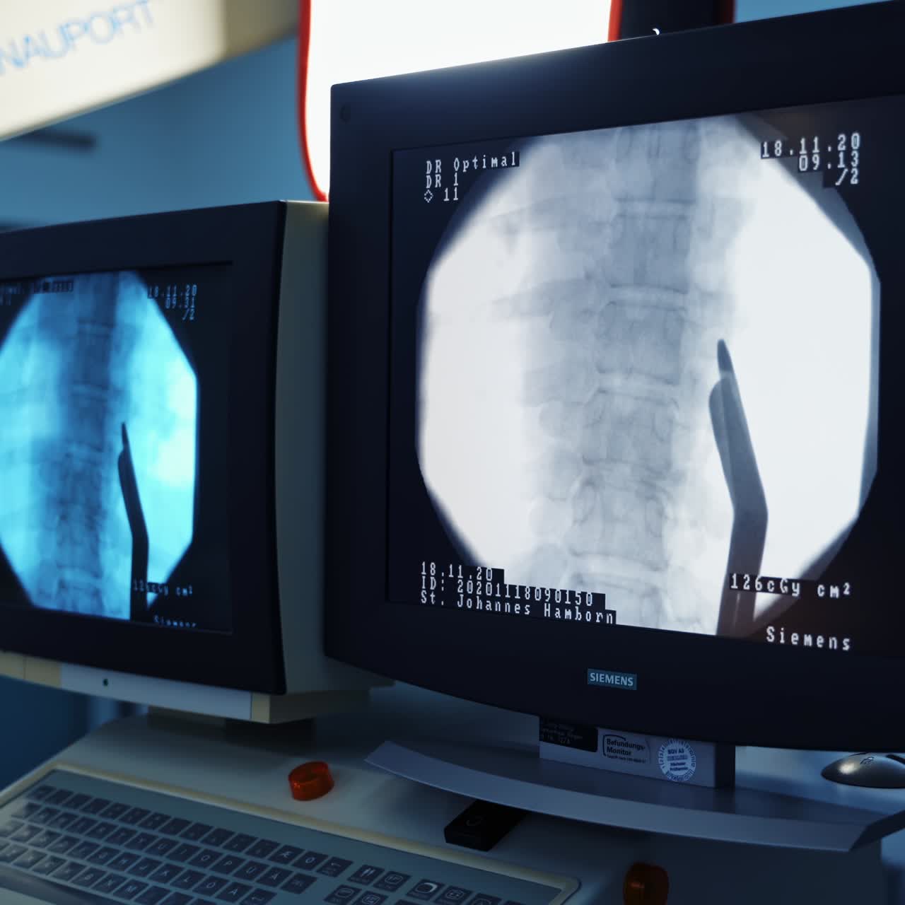 Modern equipment in operating room. Spine Surgery. X-rays of the spine