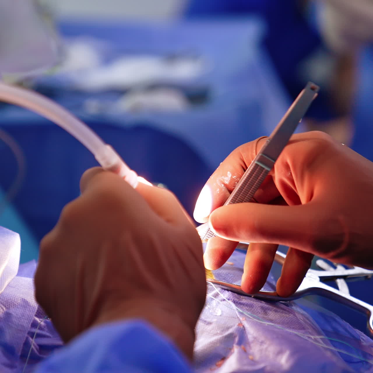 Gloved hands of a doctor holding neurosurgical tools and applying them in operation. Close up. Blurred backdrop.