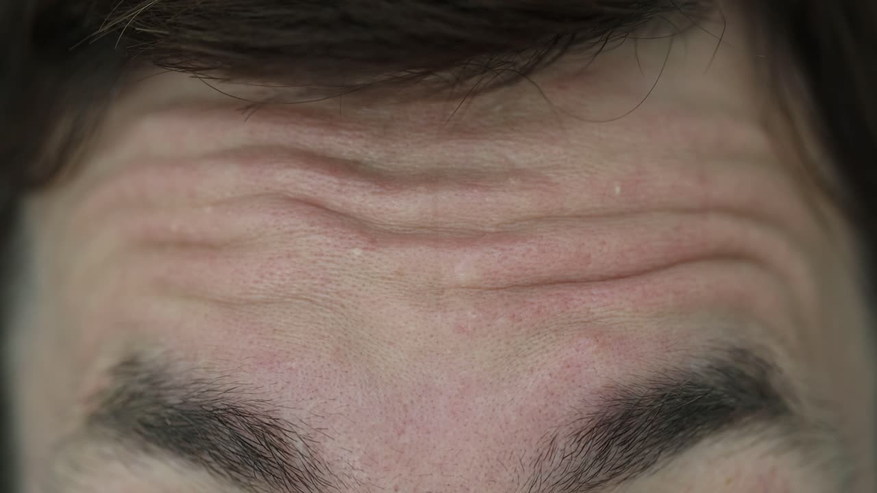 Close-up of a Human Forehead with Wrinkles and Relaxed Skin