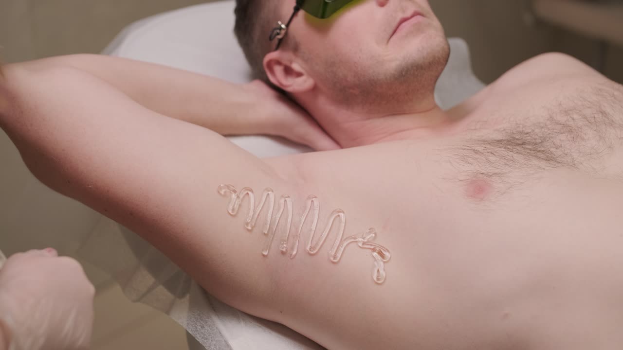 현대 화장품 클리닉에서 레이저 탈모 절차를 수행하는 동안 남자 팔꿈치 지역. 남자 아름다움, 화장품, 탈모의 개념